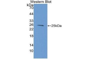 Western Blotting (WB) image for anti-Proteasome (Prosome, Macropain) Subunit, beta Type, 9 (Large Multifunctional Peptidase 2) (PSMB9) (AA 22-219) antibody (ABIN1980450) (PSMB9 antibody  (AA 22-219))