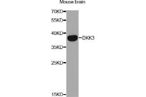 Western Blotting (WB) image for anti-DKK3 (AA 22-350) antibody (ABIN6219615) (DKK3 antibody  (AA 22-350))