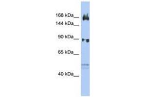 Image no. 1 for anti-AF4/FMR2 Family, Member 2 (AFF2) (N-Term) antibody (ABIN6742451) (AFF2 antibody  (N-Term))