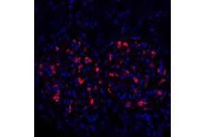 Immunofluorescence (IF) image for anti-Tight Junction Protein 1 (TJP1) (AA 650-700) antibody (ABIN7453989) (Recombinant TJP1 antibody  (AA 650-700))
