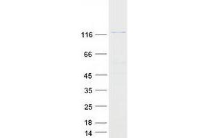 Western Blotting (WB) image for SEC31 Homolog B (SEC31B) protein (Myc-DYKDDDDK Tag) (ABIN2731579)