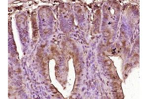 Paraformaldehyde-fixed, paraffin embedded mouse intestine tissue, Antigen retrieval by boiling in sodium citrate buffer (pH6. (GIP antibody  (AA 52-93))