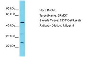 Image no. 1 for anti-Sterile alpha Motif Domain Containing 7 (SAMD7) (AA 175-224) antibody (ABIN6750794) (SAMD7 antibody  (AA 175-224))
