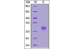 CD8 alpha Protein (AA 22-182) (His tag)