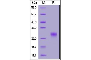 Human CD8 alpha, His Tag on  under reducing (R) condition. (CD8 alpha Protein (AA 22-182) (His tag))