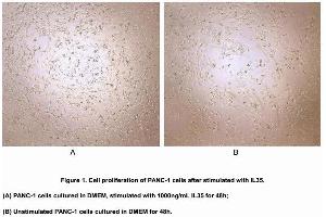 Image no. 2 for Interleukin 35 (IL35) (AA 21-229), (AA 23-219) (Active) protein (His tag) (ABIN6239772)