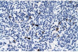 Immunohistochemical staining (Formalin-fixed paraffin-embedded sections) of human spleen with HTR3B polyclonal antibody . (Serotonin Receptor 3B antibody  (AA 8-57))