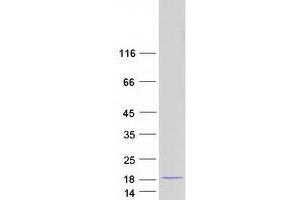 Western Blotting (WB) image for NHP2 Non-Histone Chromosome Protein 2-Like 1 (NHP2L1) (Transcript Variant 2) protein (Myc-DYKDDDDK Tag) (ABIN2727261)