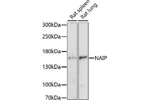 Western blot analysis of extracts of various cell lines, using NAIP antibody (ABIN7268932) at 1:1000 dilution. (NAIP antibody  (AA 750-850))