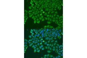 Immunofluorescence analysis of U2OS cells using CAST antibody (ABIN6290228) at dilution of 1:100.