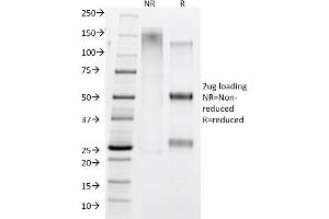 SDS-PAGE Analysis IgG4 Mouse Monoclonal Antibody (IGHG4/1345). (IGHG4 antibody)