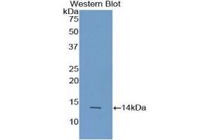 Detection of Recombinant AGRP, Human using Polyclonal Antibody to Agouti Related Protein (AGRP) (AGRP antibody  (AA 20-130))