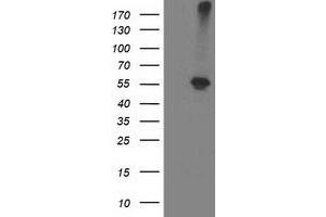 Western Blotting (WB) image for anti-Alcohol Dehydrogenase 1B (Class I), beta Polypeptide (ADH1B) antibody (ABIN1496476) (ADH1B antibody)