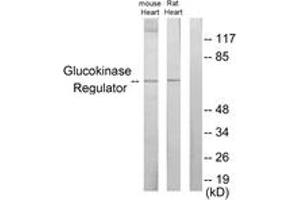 Western blot analysis of extracts from mouse heart/rat heart cells, using Glucokinase Regulator Antibody.