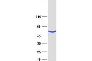 Vesicle Amine Transport 1-Like (VAT1L) protein (Myc-DYKDDDDK Tag)