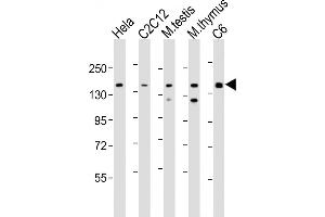 All lanes : Anti-Smarcc1 Antibody (C-term) at 1:2000 dilution Lane 1: Hela whole cell lysate Lane 2: C2C12 whole cell lysate Lane 3: mouse testis lysate Lane 4: mouse thymus lysate Lane 5: C6 whole cell lysate Lysates/proteins at 20 μg per lane. (SMARCC1 antibody  (C-Term))