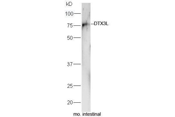 DTX3L 抗体  (AA 651-740)