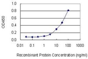 Detection limit for recombinant GST tagged EIF4E2 is 1 ng/ml as a capture antibody. (EIF4E2 antibody  (AA 1-245))