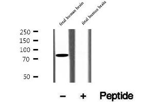 Western blot analysis of extracts of fetal human brain tissue, using CIN85 antibody. (SH3KBP1 antibody  (N-Term))