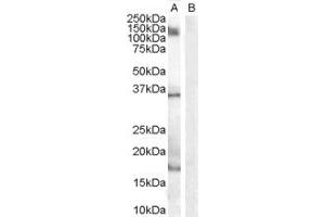 ABIN185597 (1µg/ml) staining of Human Peripheral Blood Mononucleocyte lysate (35µg protein in RIPA buffer) with (B) and without (A) blocking with the immunising peptide.