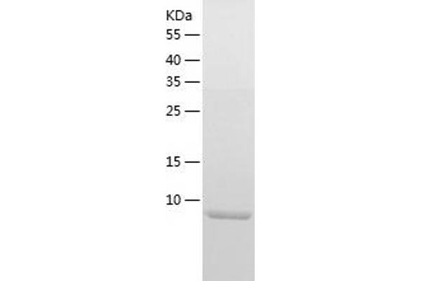 beta 2 Defensin Protein (AA 23-63) (His tag)