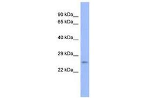 Image no. 1 for anti-Proteasome (Prosome, Macropain) Subunit, beta Type, 6 (PSMB6) (AA 35-84) antibody (ABIN6744084) (PSMB6 antibody  (AA 35-84))