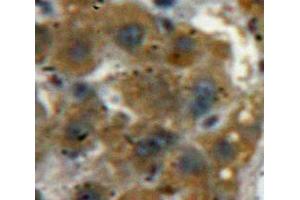 Used in DAB staining on fromalin fixed paraffin-embedded Liver tissue (ACP1 antibody  (AA 40-158))