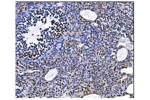 IHC analysis of EHMT2/G9A using anti-EHMT2/G9A antibody (ABIN7602084).
