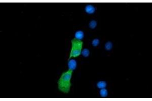 Anti-SSSCA1 mouse monoclonal antibody (ABIN2453694) immunofluorescent staining of COS7 cells transiently transfected by pCMV6-ENTRY SSSCA1 (RC201946). (SSSCA1 antibody)