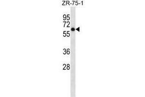 ARSD Antibody (C-term) western blot analysis in ZR-75-1 cell line lysates (35µg/lane). (Arylsulfatase D antibody  (C-Term))