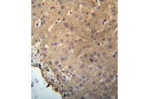 CHB Antibody (N-term) (ABIN657226 and ABIN2846328) immunohistochemistry analysis in formalin fixed and paraffin embedded human liver tissue followed by peroxidase conjugation of the secondary antibody and DAB staining.
