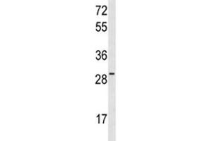 Western blot analysis of HES6 antibody and MCF-7 lysate. (HES6 antibody  (AA 6-34))
