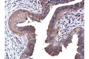 IHC-P Image PFKL antibody [C1C3] detects PFKL protein at cytoplasm in mouse cervix by immunohistochemical analysis. (PFKL antibody  (Center))