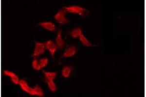 ABIN6275543 staining 293 by IF/ICC. (ULK3 antibody  (Internal Region))