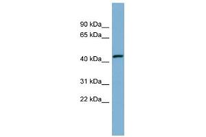 WB Suggested Anti-EFCAB4B Antibody Titration:  0. (EFCAB4B antibody  (Middle Region))
