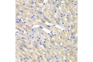 Immunohistochemistry of paraffin-embedded mouse heart using CARS antibody (ABIN5973924) at dilution of 1/100 (40x lens). (CARS antibody)