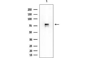 Western blot analysis of lysates from Rat lung, using KATNAL2 Mouse Monoclonal Antibody at 1/1000 dilution.