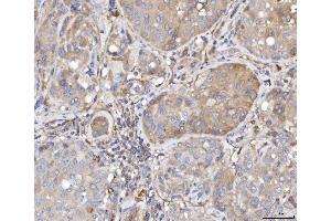 IHC analysis of TTC11/FIS1 using anti-TTC11/FIS1 antibody (ABIN7600321).