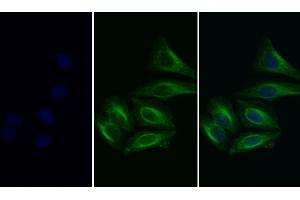 Detection of H-FABP in Human HepG2 cell using Polyclonal Antibody to Heart-type Fatty Acid Binding Protein (H-FABP)