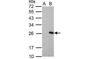 WB Image Sample (30 ug of whole cell lysate) A: Non-transfected 293T lysates B: RGS17 transfected 293T lysates 12% SDS PAGE antibody diluted at 1:5000 (RGS17 antibody  (C-Term))