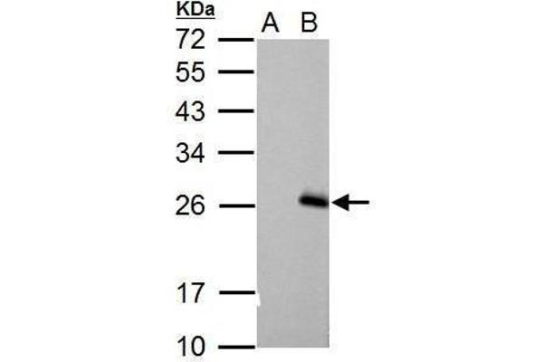 RGS17 抗体  (C-Term)