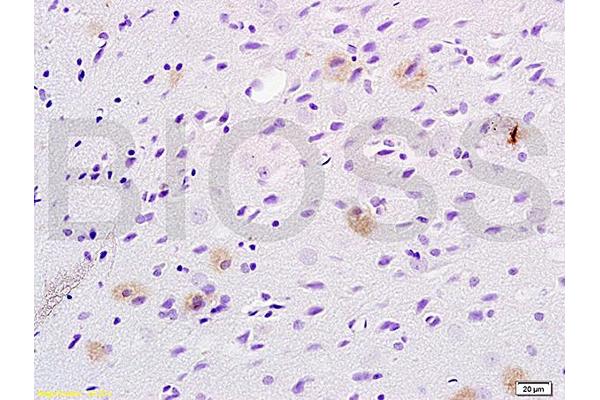 TSG101 antibody  (AA 4-120)