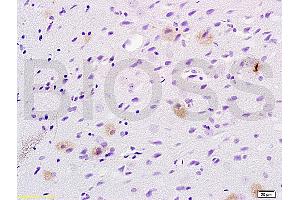 Formalin-fixed and paraffin embedded rat brain tissue labeled with Anti-Tsg101 Polyclonal Antibody (ABIN685507), Unconjugated at 1:200 followed by conjugation to the secondary antibody, (SP-0023), and DAB staining (TSG101 antibody  (AA 4-120))