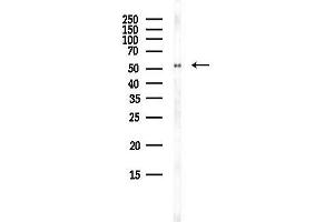 anti-Zinc Finger, DHHC-Type Containing 14 (ZDHHC14) antibody