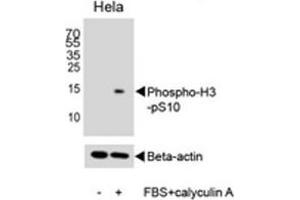 Western blot analysis of lysate from HeLa cell line, untreated or treated with FBS + Calyculin A (100ng/ml), using phospho-Histone H3 antibody