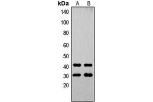 Western blot analysis of OVOL1 expression in A549 (A), Jurkat (B) whole cell lysates.