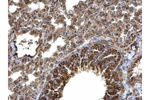 IHC-P Image Laminin alpha 4 antibody [C3], C-term detects Laminin alpha 4 protein at cytoplasm on mouse lung by immunohistochemical analysis. (LAMa4 antibody  (C-Term))