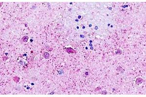 Human, Brain, neurons: Formalin-Fixed Paraffin-Embedded (FFPE (GPR162 antibody  (Transmembrane Domain))