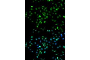 Immunofluorescence analysis of MCF-7 cells using RBBP6 antibody (ABIN5974190). (RBBP6 antibody)