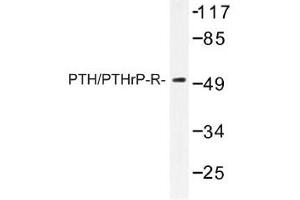 Image no. 1 for anti-Parathyroid Hormone 1 Receptor (PTH1R) antibody (ABIN317698) (PTH1R antibody)